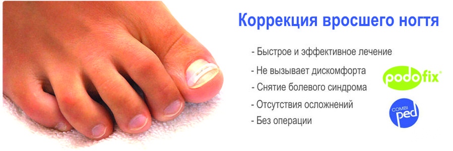 Лечение ногтей спб