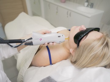 Александритовая лазерная эпиляция
